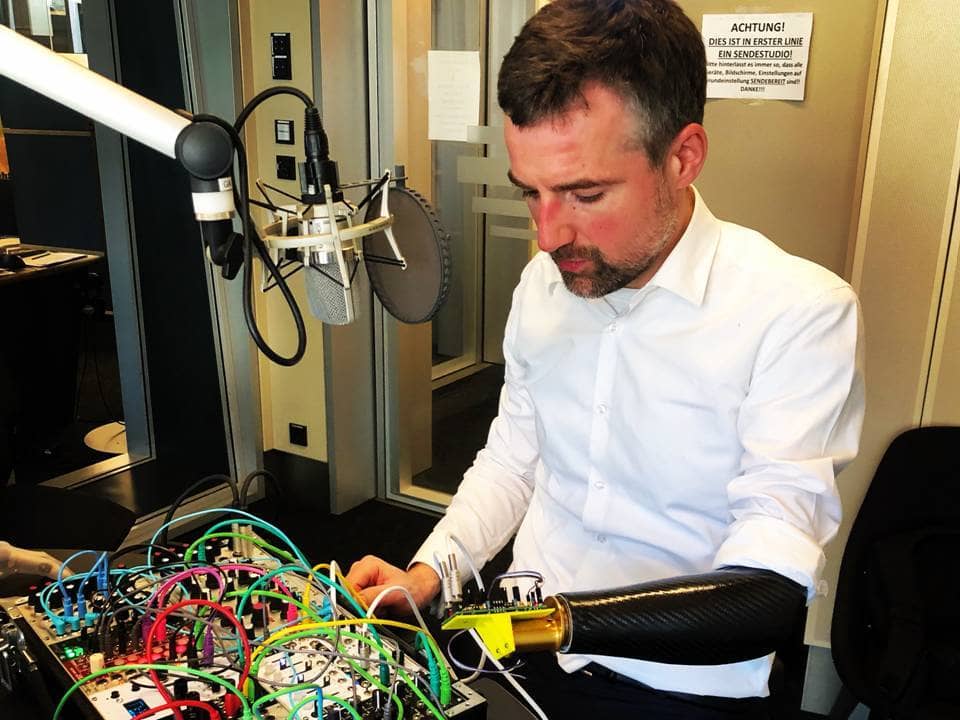 Mann mit Armprothese vor elektronischem Musikinstrument